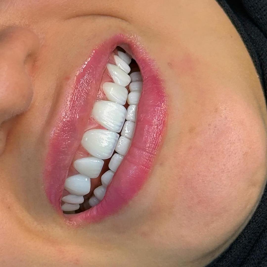 Dental After